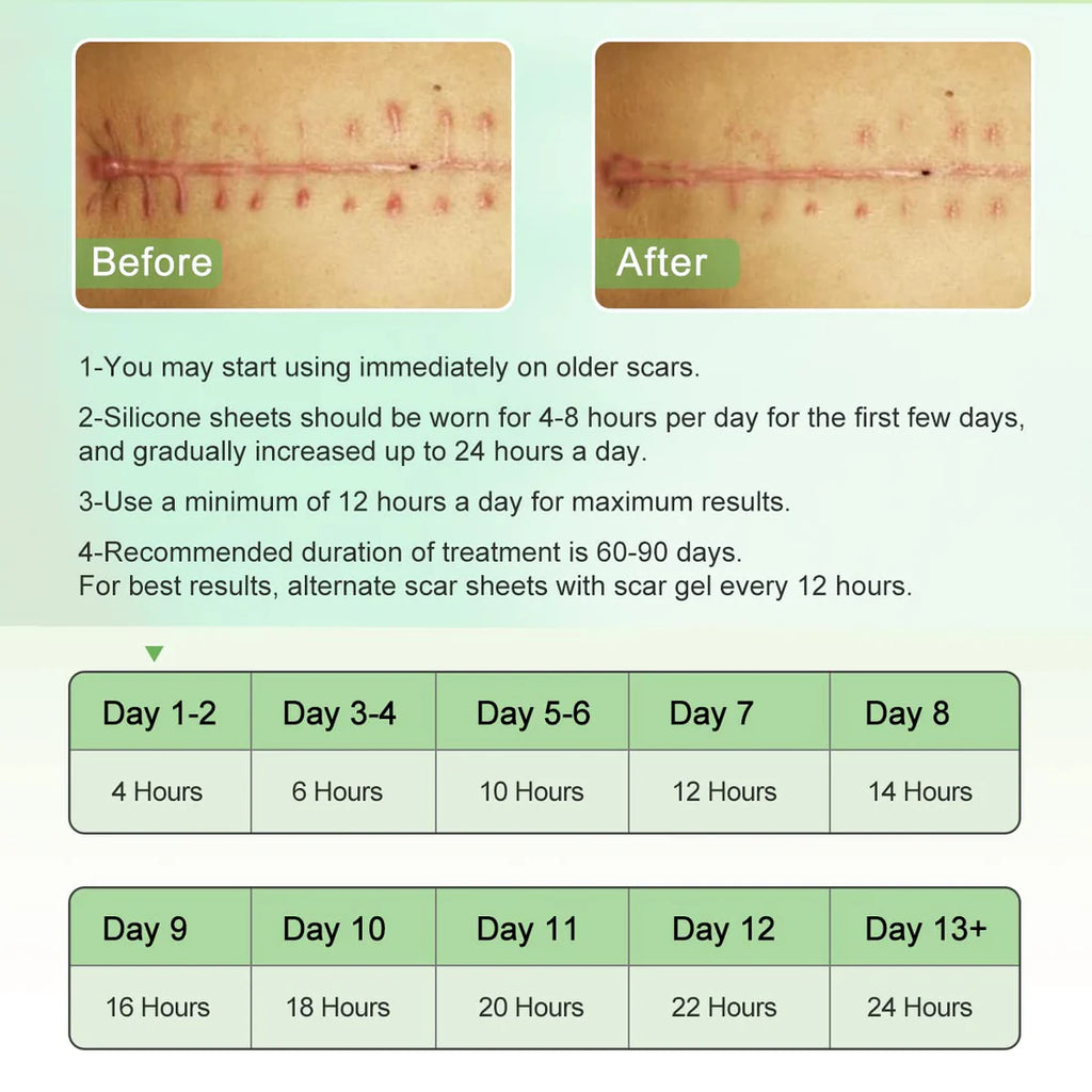 Silicone Scar Sheets