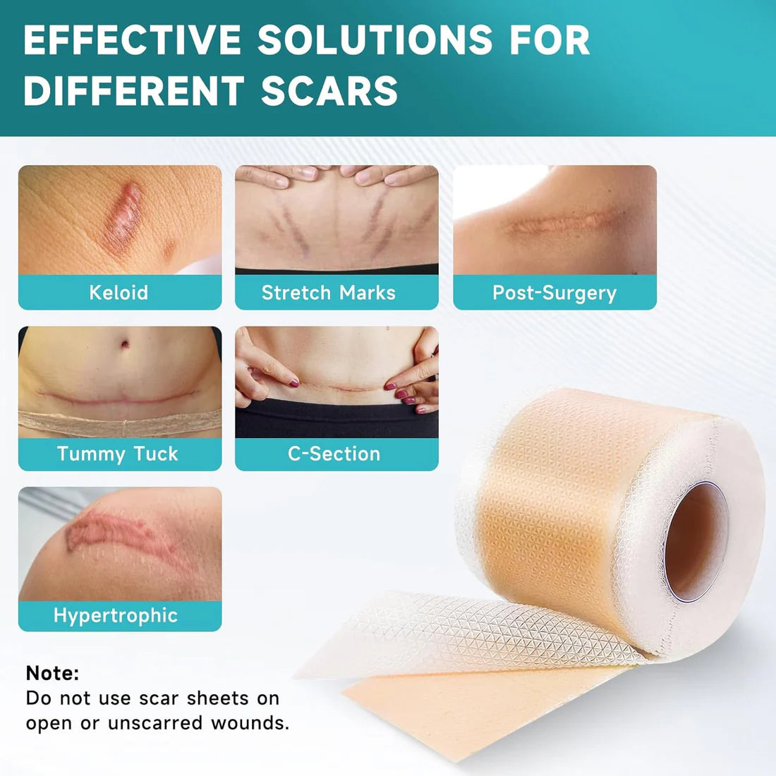 Scar Papper Silicone Scar Sheets – Glarne