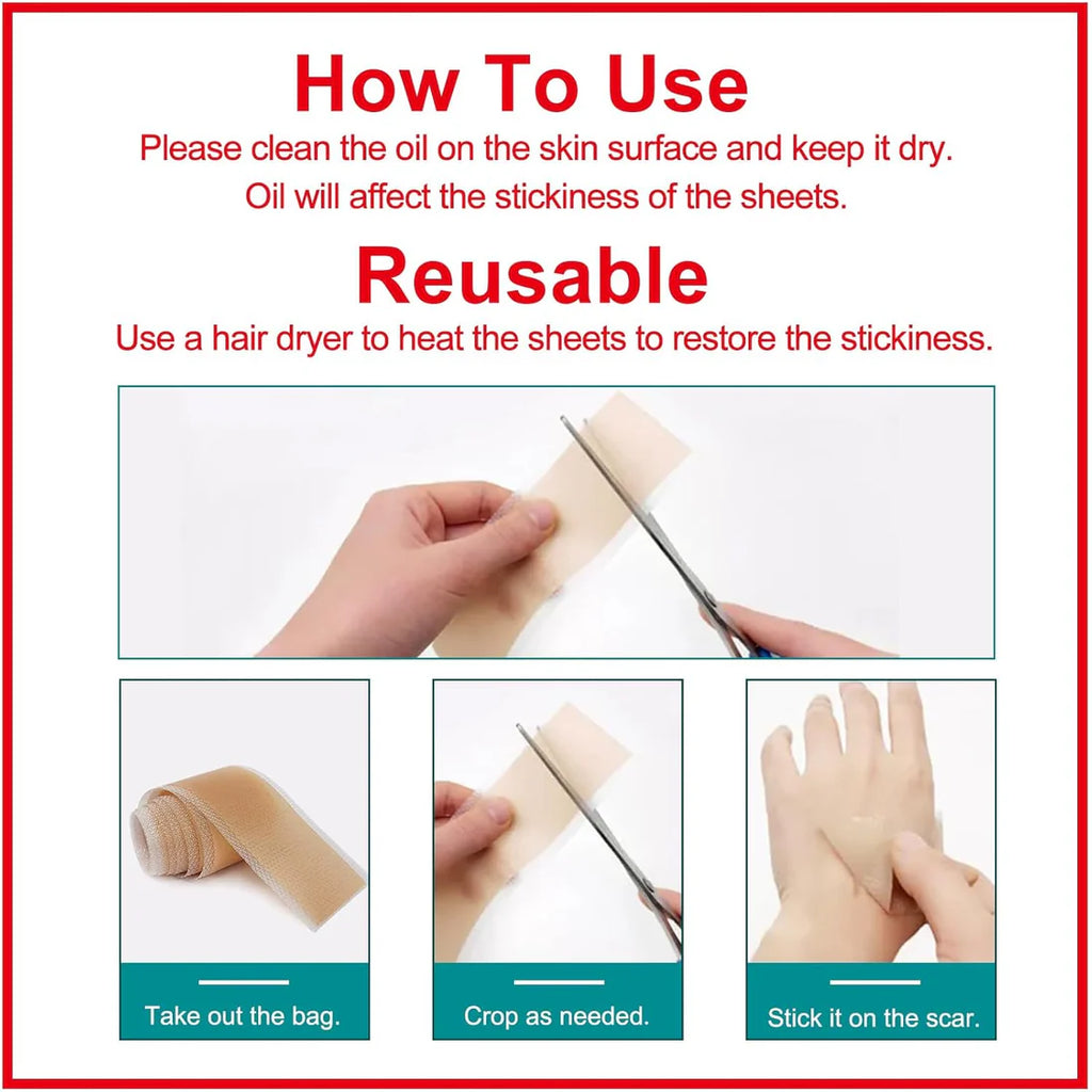 Silicone Scar Sheets