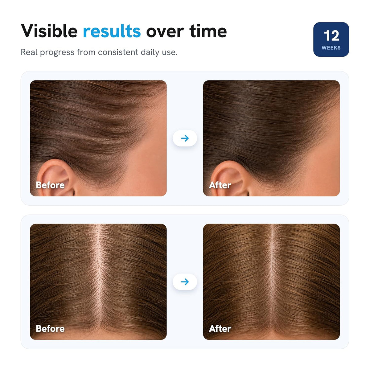 Hair Growth Roll On Serum