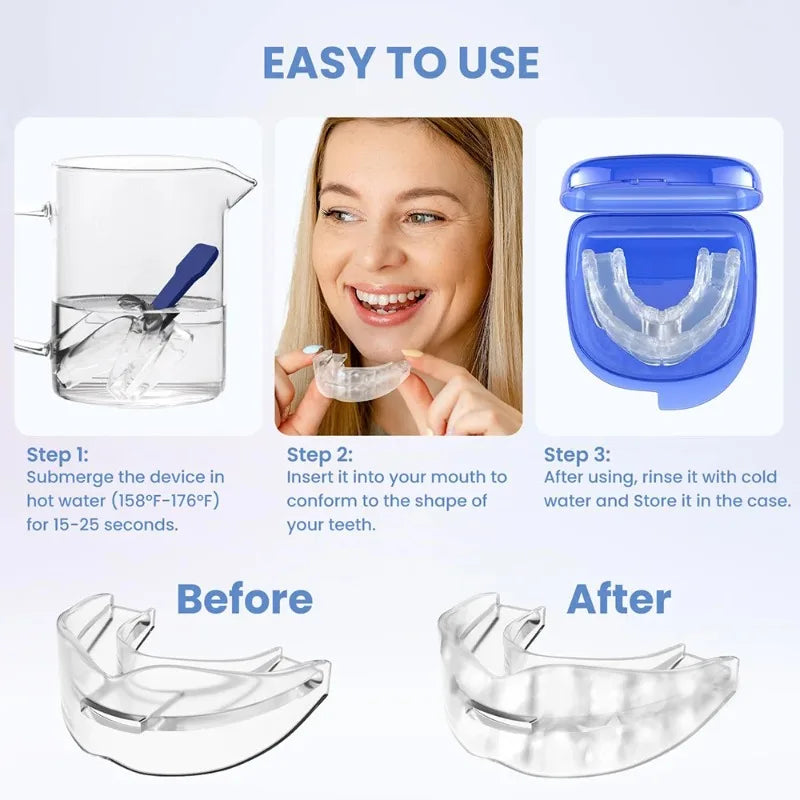 ZQuiet™ Anti Snore Mouthpiece