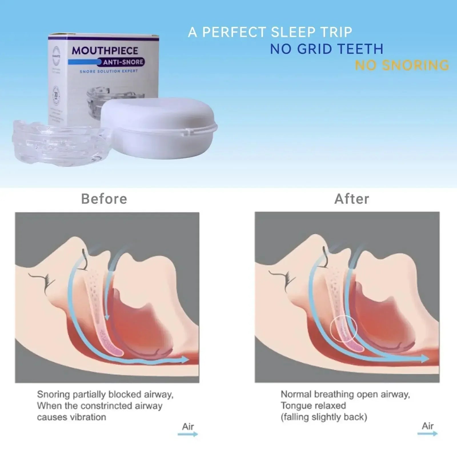 MOUTHPIECE™ Snore Solution Expert